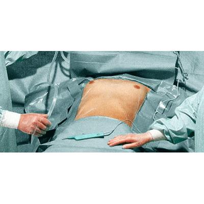 Hartmann Fdrape PP Cardiovasculaire Set P3 | Pak (3 stuks)