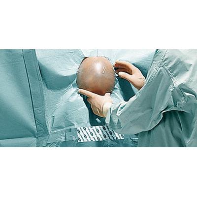 Hartmann Fdrape PP Neurochirurgieset II P5 | Pak (5 stuks)