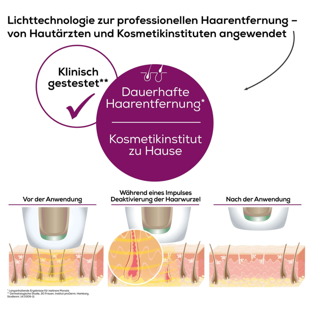 Een Duitse infographic over ontharingstechnologie met de Beurer Permanente Ontharing IPL VelvetSkinPro Black illustreert het proces voor, tijdens en na het gebruik. De tekst benadrukt de professionele permanente ontharing voor thuisgebruik, getest door dermatologen en schoonheidsinstituten. De afbeeldingen tonen de ontharing.