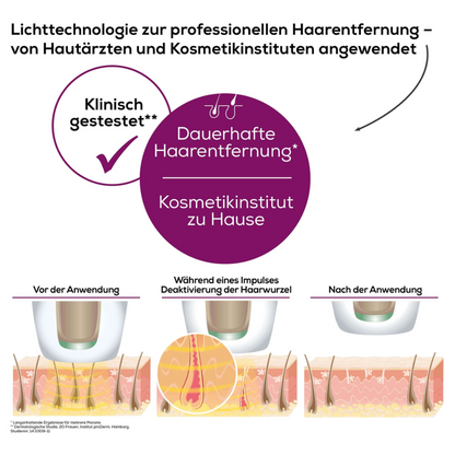 Een Duitse infographic over ontharingstechnologie met de Beurer Permanente Ontharing IPL VelvetSkinPro Black illustreert het proces voor, tijdens en na het gebruik. De tekst benadrukt de professionele permanente ontharing voor thuisgebruik, getest door dermatologen en schoonheidsinstituten. De afbeeldingen tonen de ontharing.