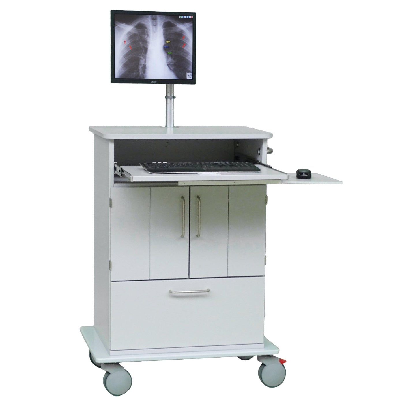 De Novocal EDV-wagen beschikt over een kunststof blad, een computermonitor met thoraxröntgenbeeld, een uitschuifbaar blad voor toetsenbord en muis, daaronder liggende opbergvakken en wielen voor het eenvoudig transporteren van de EDV-uitrusting.