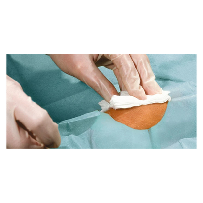 Een close-up van gehandschoende handen die een klein huidgebied reinigen met een witte doek, omgeven door blauwgroene Hartmann Foliodrape® Protect Lochtücher, zelfklevend, steriel, individueel verpakt, van Paul Hartmann AG.